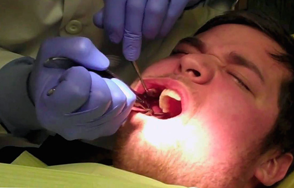 Norint, kad dantų nusiurbimo procedūra vyktų be problemų, pravartu žinoti keletą niuansų ...