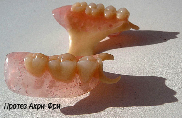 I fermagli in plastica della protesi Acre-Free sono meno visibili nella cavità orale rispetto a quelli in metallo.