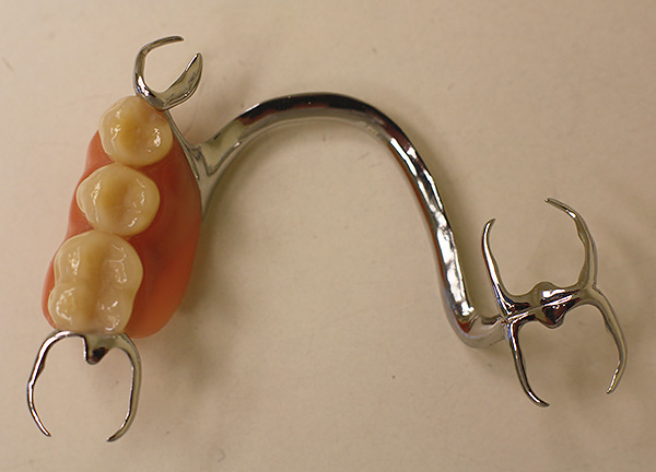 Clasp prosthesis with clasps