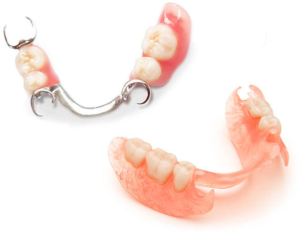 دعنا نرى ما هي أفضل البدلات الاصطناعية مع غياب جزئي للأسنان في تجويف الفم ...