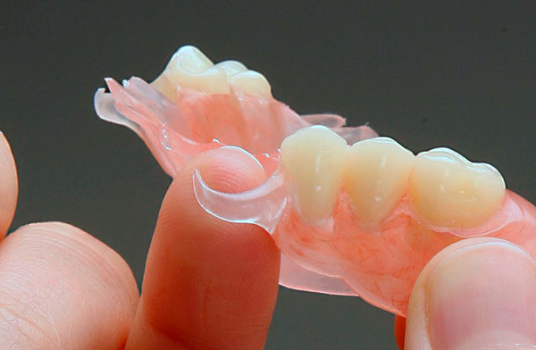 Miękkie nylonowe haczyki nie są w stanie bezpiecznie utrzymać struktury w jamie ustnej.