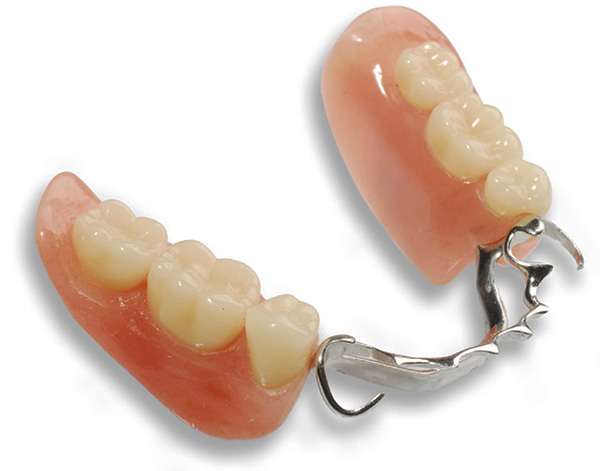 في العديد من الحالات السريرية ، يكون استخدام طرف اصطناعي للمشبك هو أفضل خيار للأطراف الاصطناعية للأسنان المفقودة.