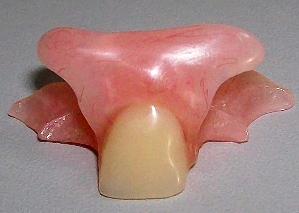 Prostesis dentur segera