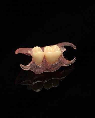 Two-tooth butterfly prosthesis.