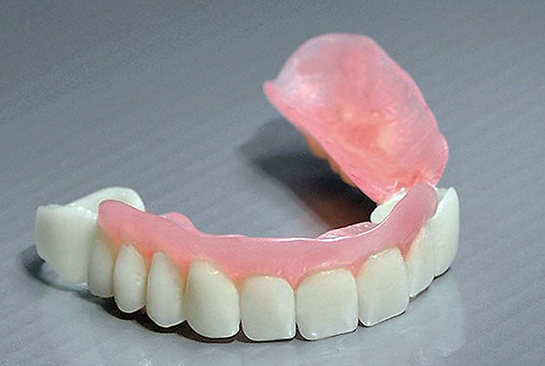 ฟันปลอมแบบถอดได้รุ่นใหม่ที่ไม่มีเพดานปาก