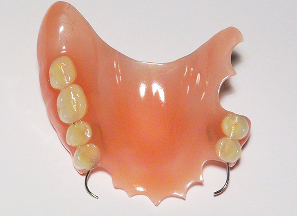 Partial acrylic denture (on the upper jaw)