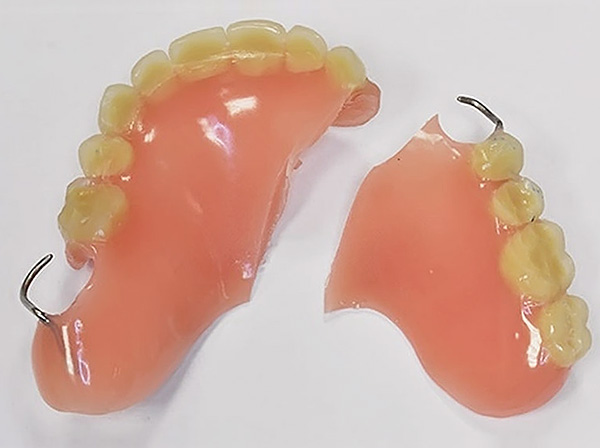 A broken denture is better attributed to a clinic for repair than trying to repair it yourself.