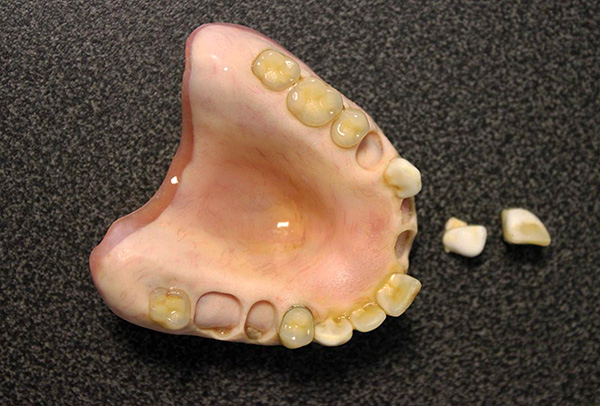Kvalita levných akrylových zubních protéz i dnes je, upřímně řečeno, nesrovnatelná.