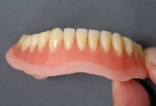 I velmi potemněnou protézu lze v zubní laboratoři prakticky obnovit do původního stavu.