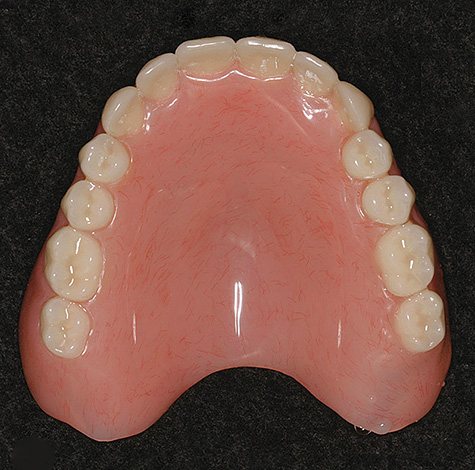 Sztywne protezy z tworzywa akrylowego pozostają dziś najtańszą opcją dla protetyki z całkowitym brakiem zębów w jamie ustnej.