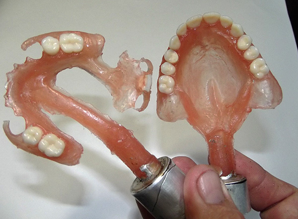 Dentadura completa de nylon removible.