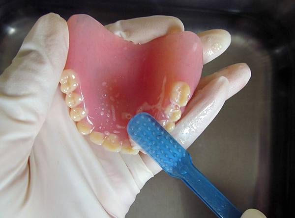 Parunāsim par to, kā pareizi rūpēties par noņemamām zobu protēzēm, lai tās kalpotu ilgu laiku un neradītu nevajadzīgas problēmas ...