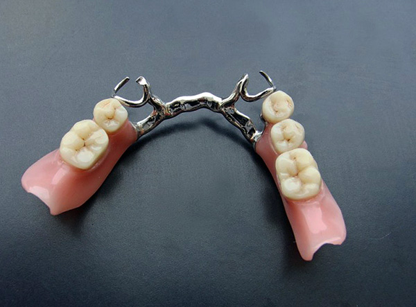 Sie sollten Ihre Prothese mindestens einmal im Jahr einem orthopädischen Zahnarzt zeigen ...