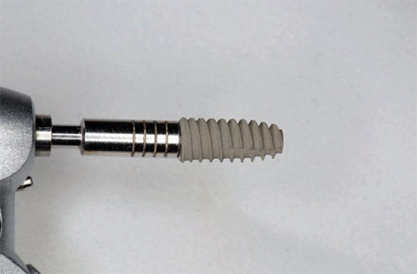 Dental implants are high-tech products that are the result of numerous studies and experiments.