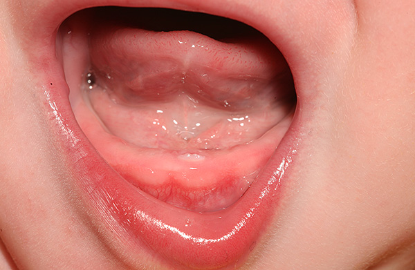Dentița nu trebuie considerată o boală gravă - este un proces fiziologic normal.