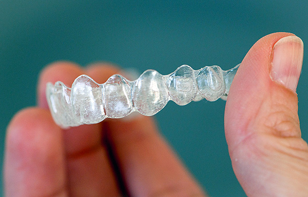 Dental clinics today often position such mouthguards as a complete replacement for bracket systems.