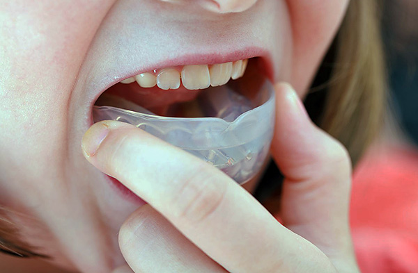 Ortodontiska tränare används inte bara för barn, utan vuxna använder dem också.
