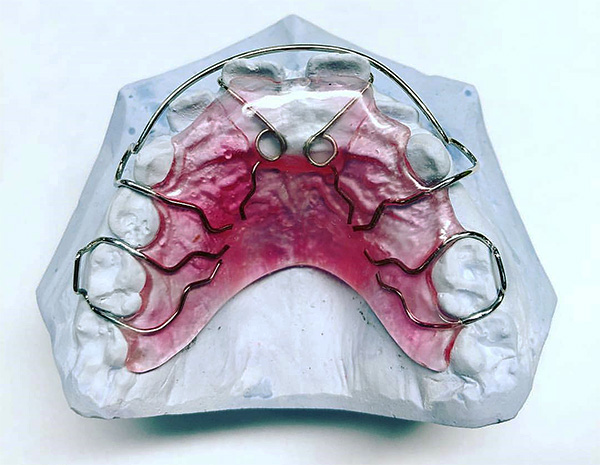Acest dispozitiv vă permite să reglați în mod eficient poziția dinților în maxilarul superior.