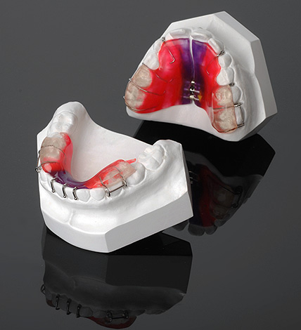 Ortodontické přístroje s dvojitou čelistí