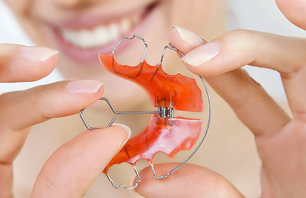 Diş ortodontik aletleri, çeneyi genişletmenize izin veren bir vidaya sahiptir.
