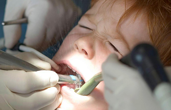 Il faut comprendre que la cause d'une douleur prolongée dans la dent peut bien être une erreur médicale commise par le dentiste lors du traitement de la pulpite.
