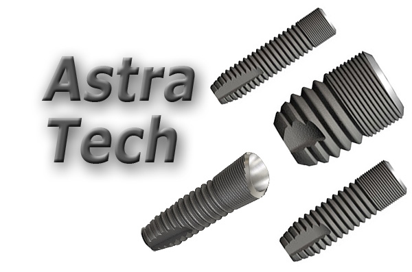 Ние считаме предимствата и недостатъците на имплантите Astra Tech (Швеция) ...