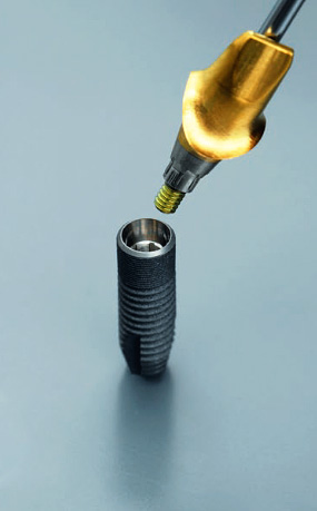 Implantáty Astra Tech mají velmi přesné kuželové spojení s opěrou.