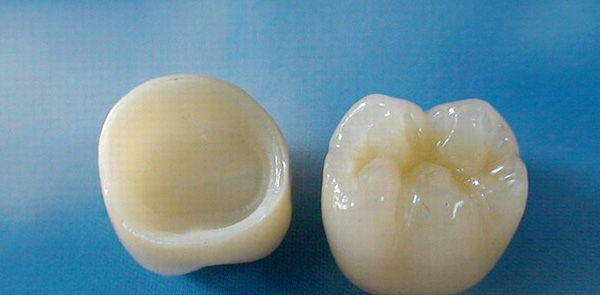 Coronas de circonita en dientes de mascar.