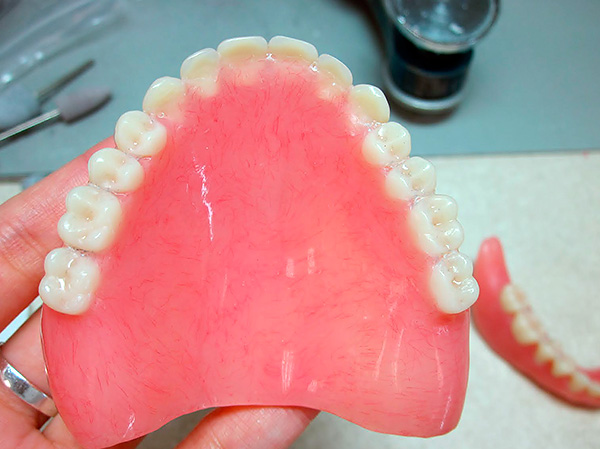 สำหรับการปลูกรากฟันเทียมขนาดเล็กคุณยังสามารถใส่อะคริลิกเทียมเก่าได้โดยทำการดัดแปลงก่อนหน้านี้